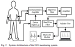 Design and implementation of low cost ECG monitoring system for the patient using smartphone