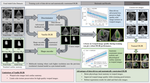 Multi-scale, data-driven and anatomically constrained deep learning image registration for adult and fetal echocardiography