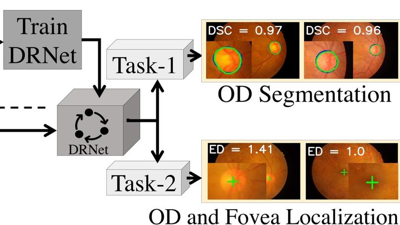DRNet: Segmentation and localization of optic disc and Fovea from diabetic retinopathy image
