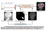 Multi-Class Probabilistic Atlas-Based Whole Heart Segmentation Method in Cardiac CT and MRI